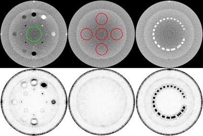 Mutual Information-Based Non-Local Total Variation Denoiser for Low-Dose Cone-Beam Computed Tomography